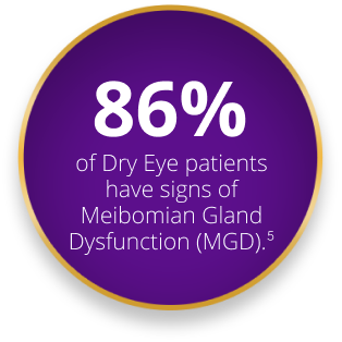86% of Dry Eye patients have signs of Meibomian Gland Dysfunction (MGD).5